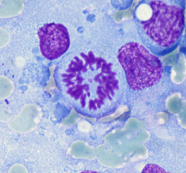 Mitosis In A Lymphoma Cell mitosis