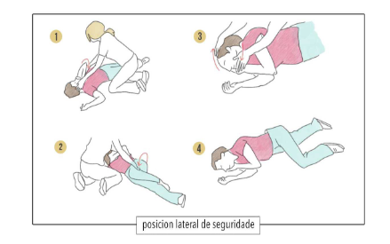 Posición Lateral de Seguridade