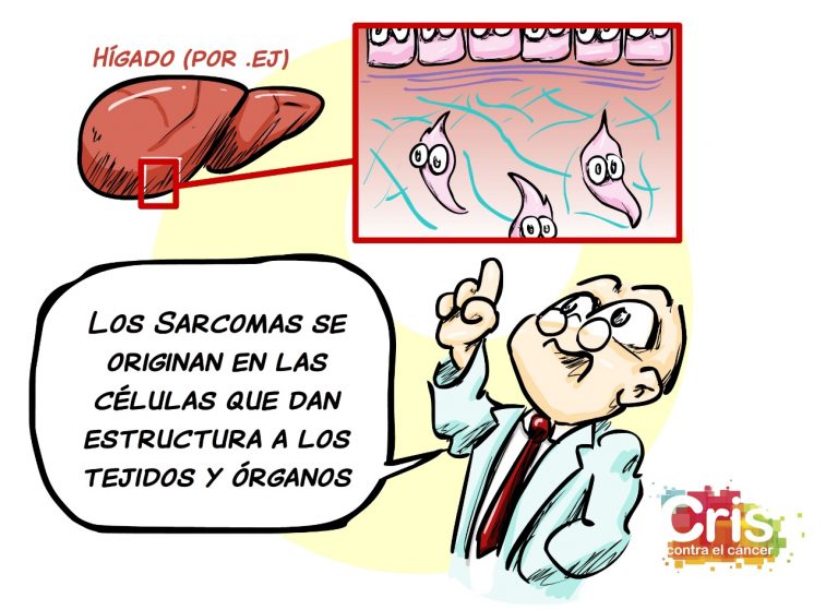 Apoio visual. Viñeta sobre o sarcoma