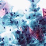 Imaxe ao microscopio dun fungo