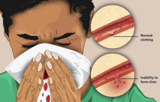 Imaxe dunha persoa con hemofilia