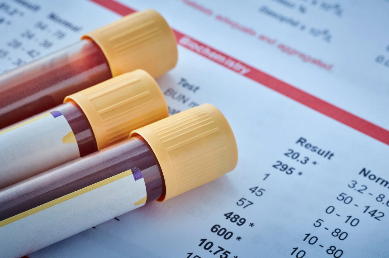 Imaxe de tubos de ensaio para mostras de sangue