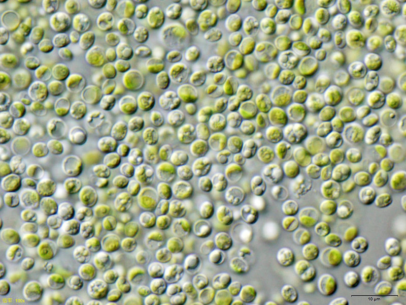 Chlorella vulgaris