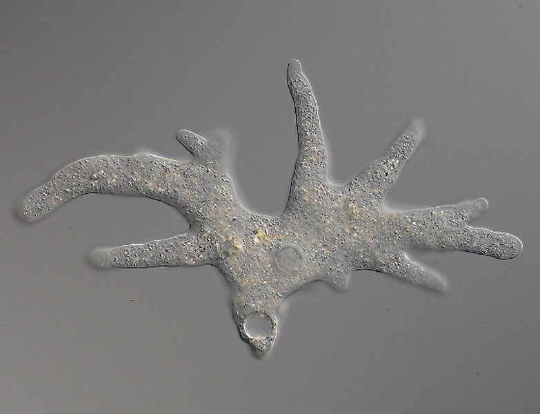 Ameba con pseudópodos