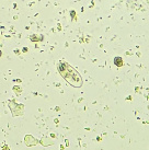 Protozoos descompeñendo restos de seres vivos