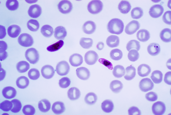 Plasmodium falciparium