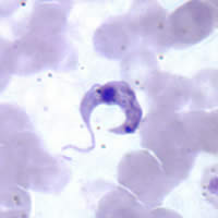 Trypanosoma cruzi