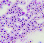 Imaxe na que se ven células da mucosa da meixela