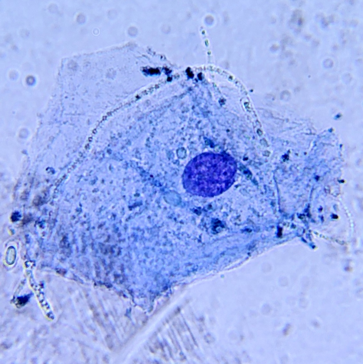 Célula da mucosa bucal humana