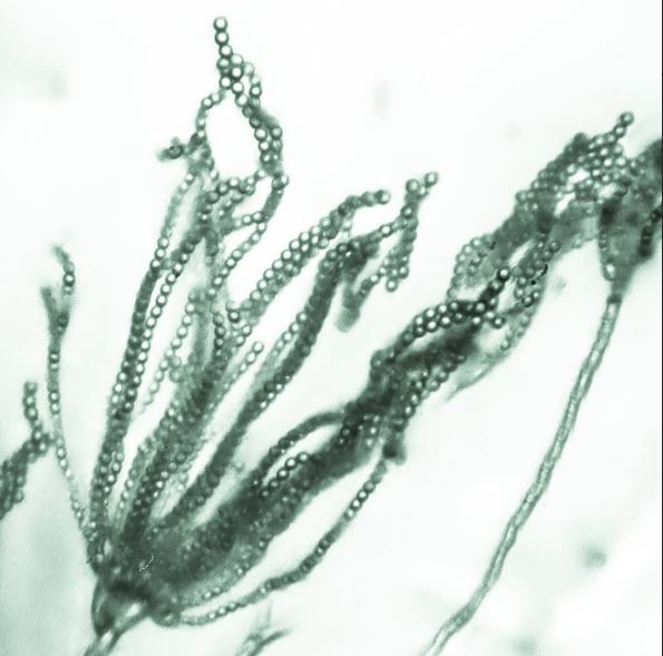 Microfotografía de Penicillium.