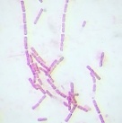 Microfotografía de células procariotas (bacterias)