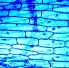 Microfotografía de células vexetais