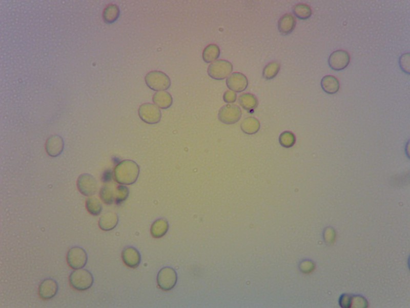 Fotografía de lévedos ao microscopio