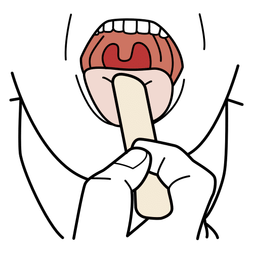 Boca abierta con un palo plano sobre la lengua.