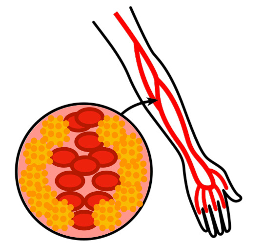 Veas con colesterol.