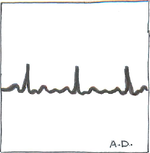 Portada del disco de los Arctic Donkeys titulado "The King is Alive"