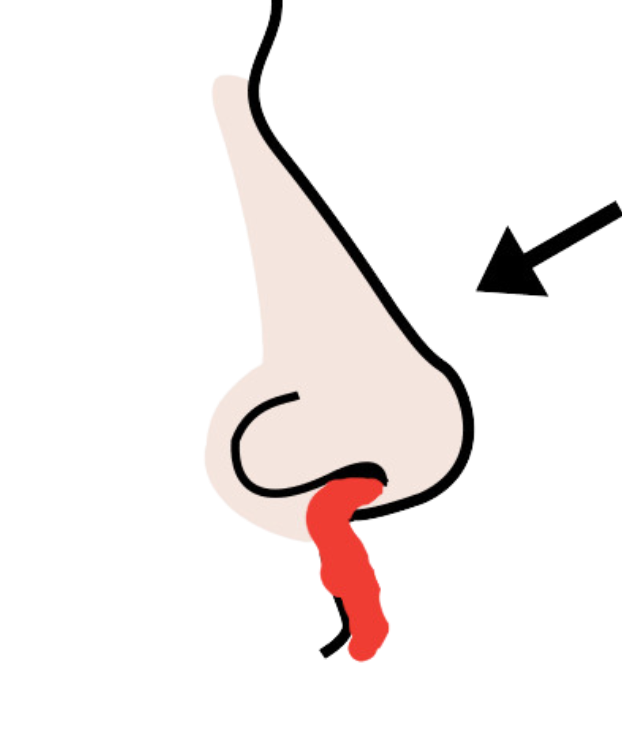 Pictograma que representa a hemorraxia nasal