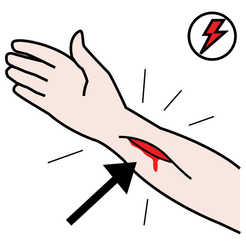 Pictograma que representa un brazo cun corte que bota sangue