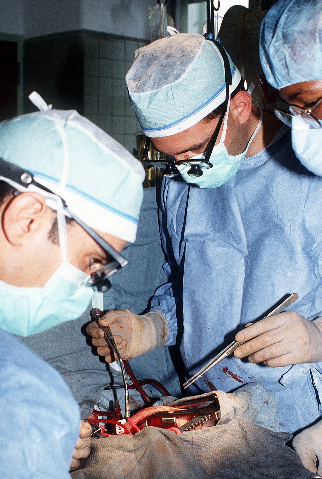 Médicos haciendo una operación