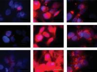 representación do metábolismo